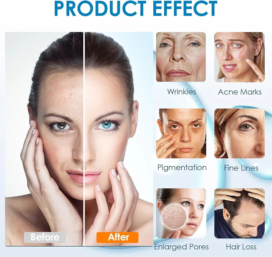 Visual before and after results of skin treatments using the 12 Pin Dr.pen A11, illustrating improvements in wrinkles, fine lines, and pigmentation.