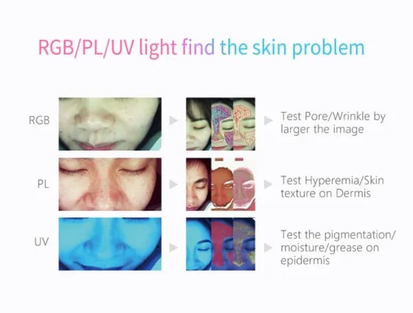 The interactive display of the Magic Mirror Skin Analyzer showing skin analysis results, functioning effectively as a Dermascop, Hair Analyser, and Skin analyser.