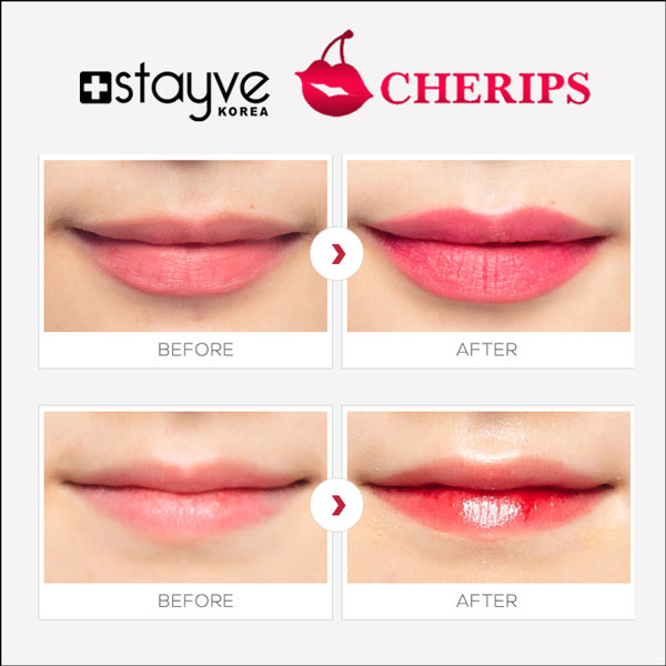 Aftercare of lips post Stayve Lip Tint application from Stayve Cherips Micro-needling Ampoules Set for Lips, showing moist lips.