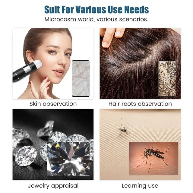 User-friendly SD Cosmetics Care Dermascope with anti-skid handle, designed for detailed magnification of small objects.
