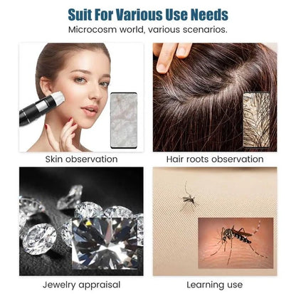 User-friendly SD Cosmetics Care Dermascope with anti-skid handle, designed for detailed magnification of small objects.