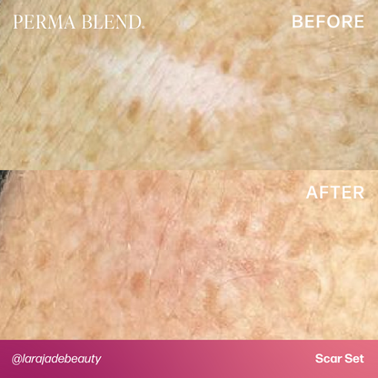 Before and after images showing the effectiveness of Permablend Light Dermis in camouflaging scars.