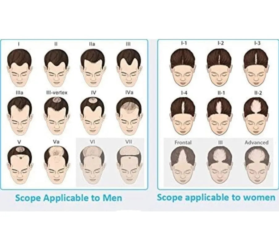 The SD Cosmetics Care Portable Laser Hair Growth Helmet in use, illustrating the large treatment area and safe hair growth solution.