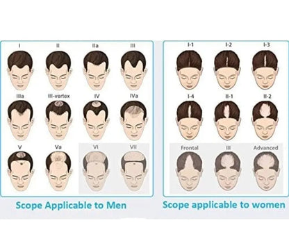The SD Cosmetics Care Portable Laser Hair Growth Helmet in use, illustrating the large treatment area and safe hair growth solution.