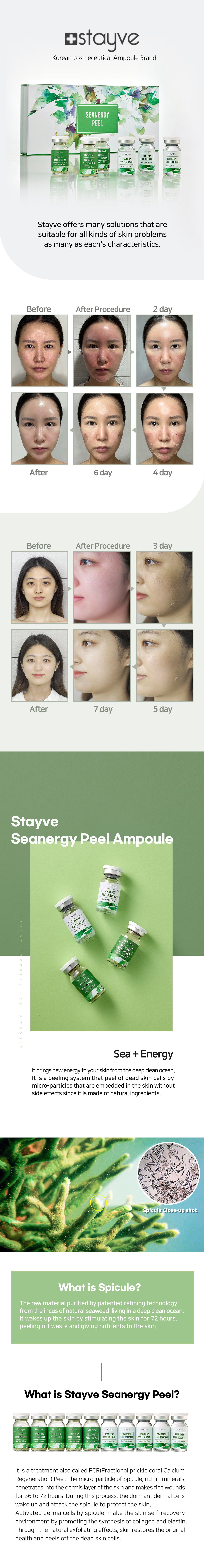 Visual summary of the Stayve Seanergy Peel treatment process with emphasis on enhancing skin texture and appearance.