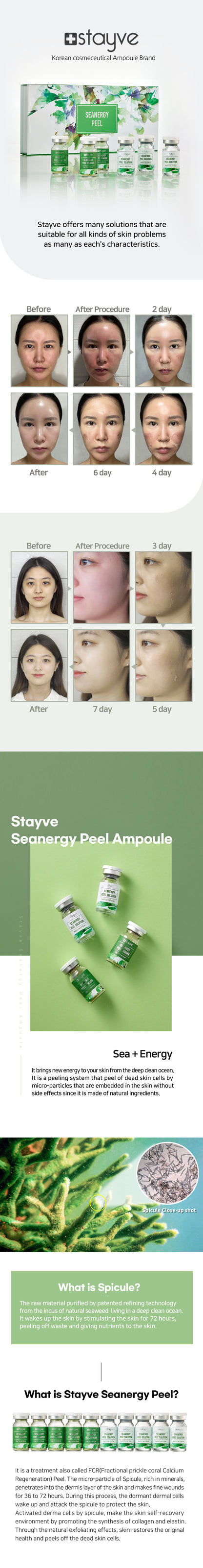 Visual summary of the Stayve Seanergy Peel treatment process with emphasis on enhancing skin texture and appearance.