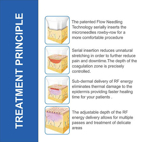 Illustration of the Portable Micro Needling Radio Frequency Mnrf Machine in action, showcasing its precision and effectiveness in skin treatment.