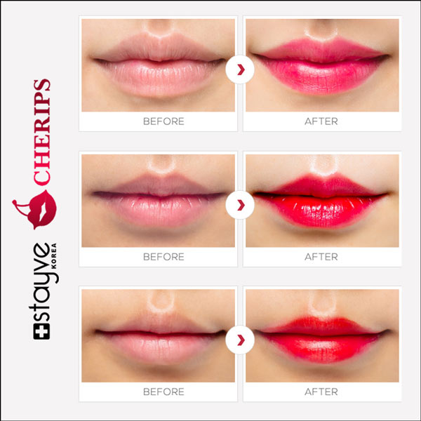 Full range of Stayve Lip Tint colors available in the Stayve Cherips Micro-needling Ampoules Set for Lips, emphasizing variety in shades.