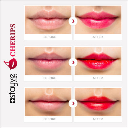 Full range of Stayve Lip Tint colors available in the Stayve Cherips Micro-needling Ampoules Set for Lips, emphasizing variety in shades.