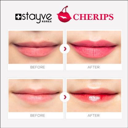 Aftercare of lips post Stayve Lip Tint application from Stayve Cherips Micro-needling Ampoules Set for Lips, showing moist lips.