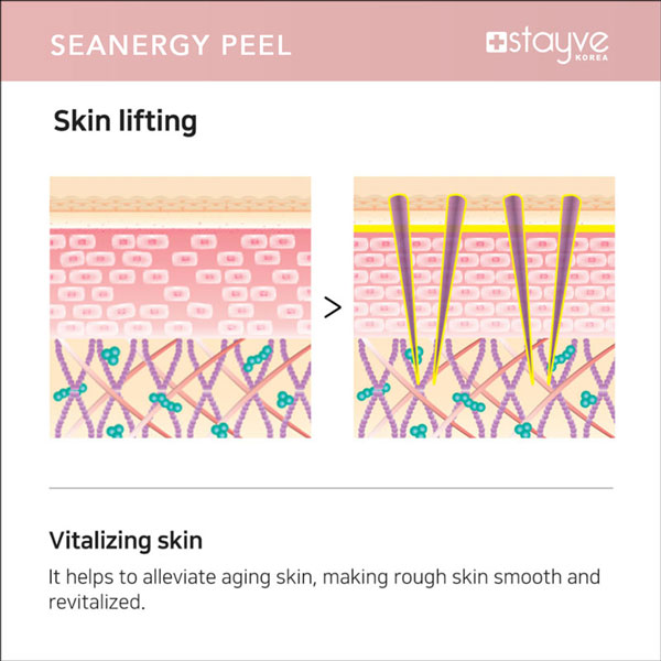 Graphics depicting skin lifting benefits from Stayve Seanergy Peel, illustrating the revitalization of aging skin through treatment.