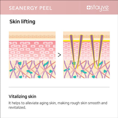 Graphics depicting skin lifting benefits from Stayve Seanergy Peel, illustrating the revitalization of aging skin through treatment.